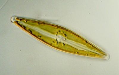 Stauroneis phoenicenteron (Nitzsch) Ehrenberg 1843