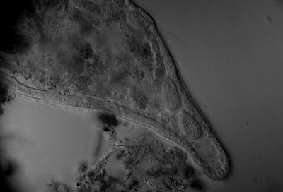 Wirek z pasożytującymi orzęskami Tetrahymena