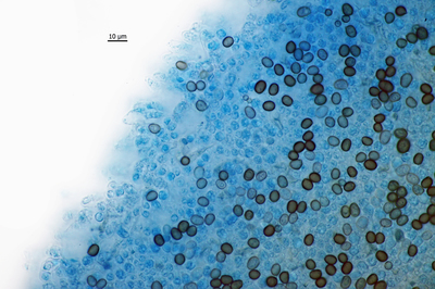 Widok zarodnikow na blaszce,barwione LPCB,1000x